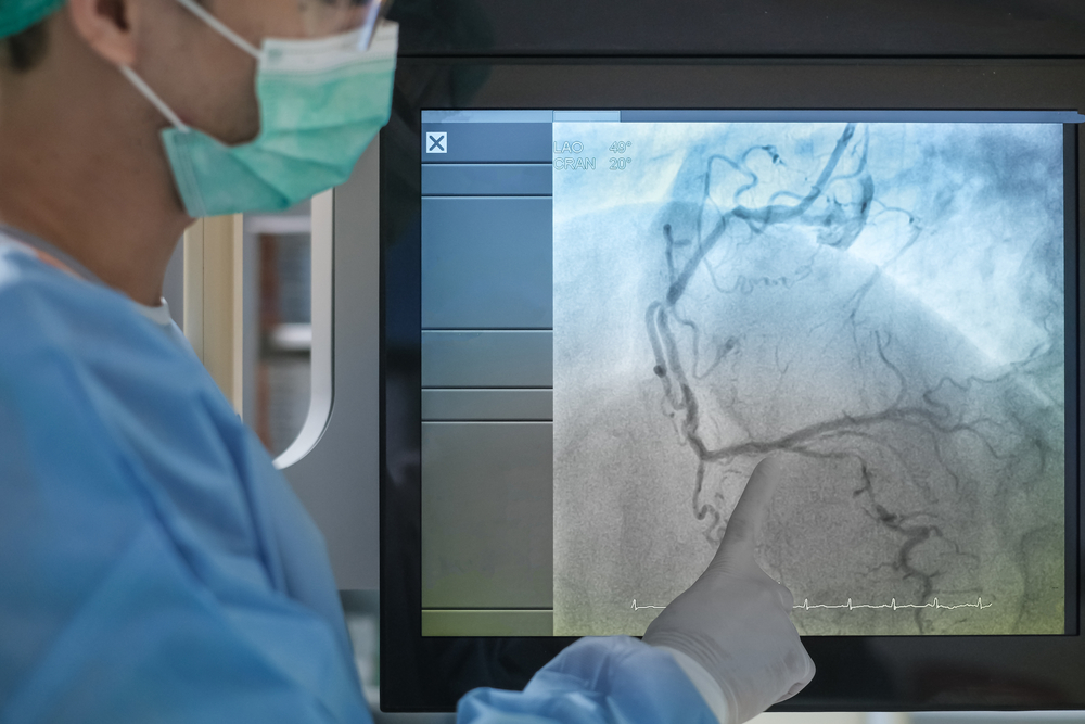 Cardiologie Cardiologie Invervenrionnelle hero